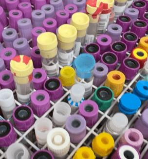 Thumbnail image of blood vials in a lab.