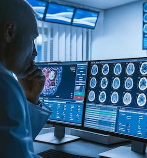 Thumbnail image of doctor looking at brain scans.